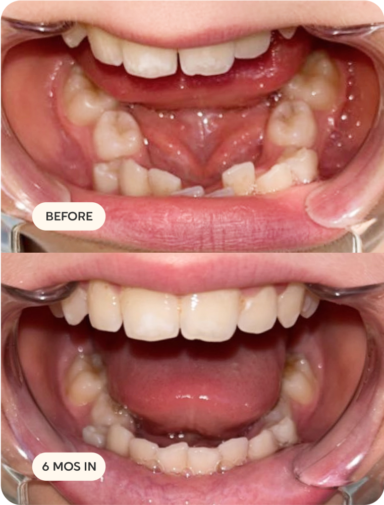 Before and after transformation