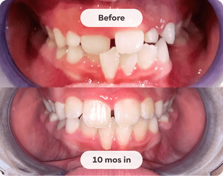 Patient result