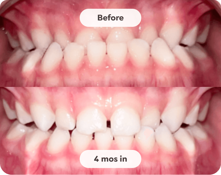 Patient result