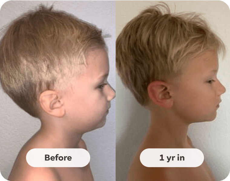 Patient result