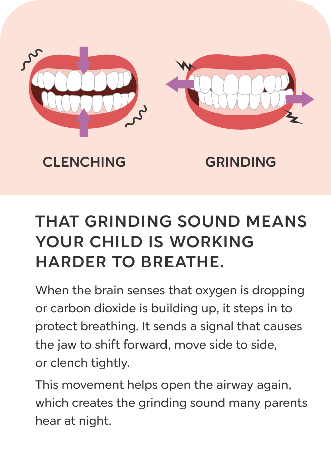 Mouth breathing slide 5